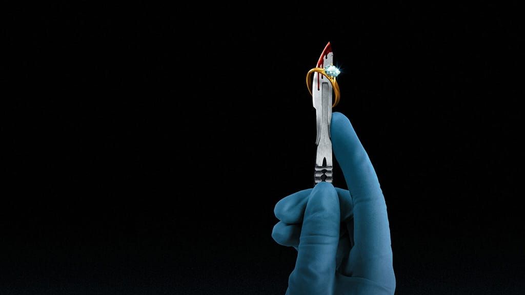 Cirurgião do Mal crítica da minissérie série documental Netflix 2023